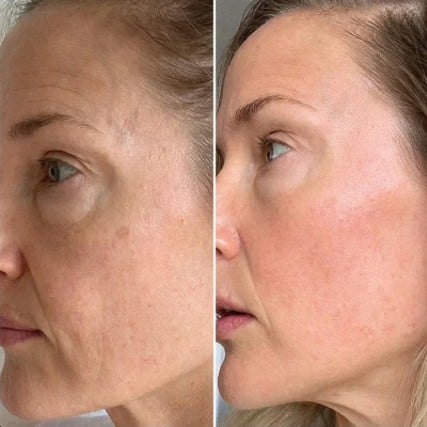 gloramd liquid solution serum